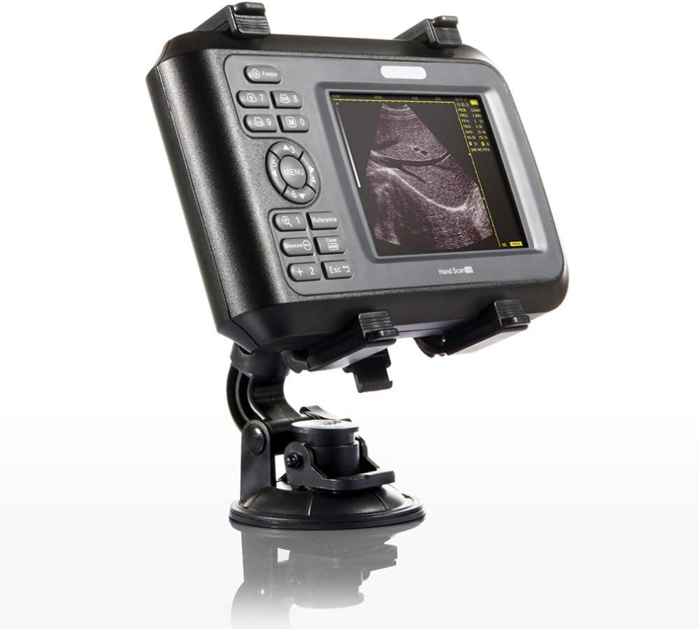 Portable Digital Veterinary Ultrasound Scanner with 4.0MHz Rectal Convex Probe U6666