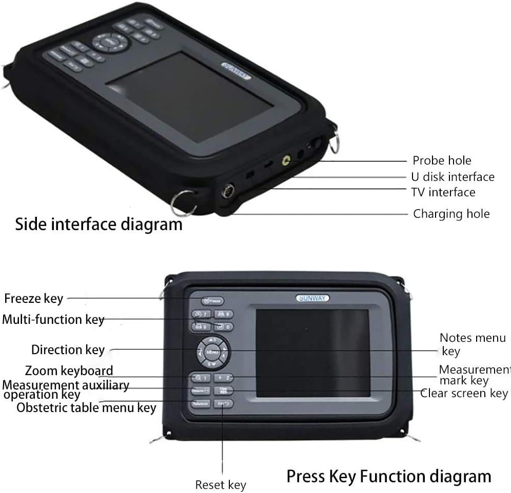 Portable Digital Veterinary Ultrasound Scanner with 4.0MHz Rectal Convex Probe U6666