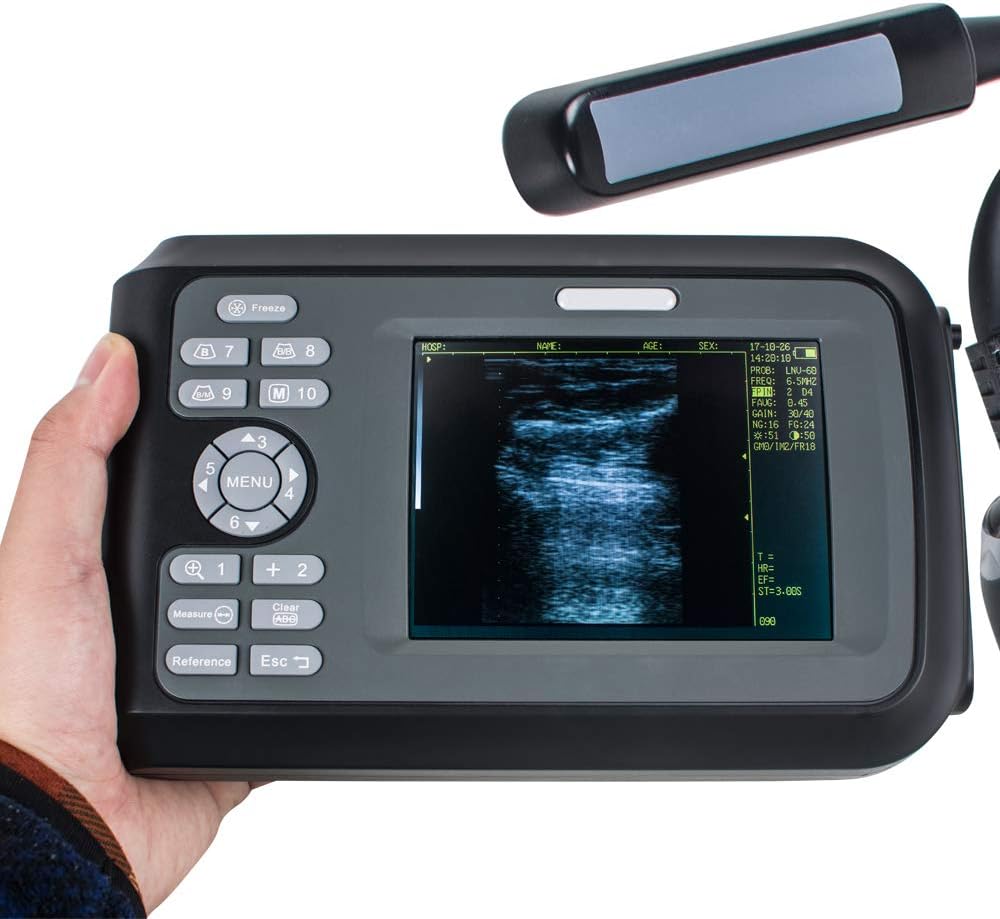 Portable Digital Veterinary Ultrasound Scanner with 4.0MHz Rectal Convex Probe U6666